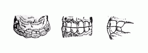 1 нас: Цөм нялхын шүд. Нялхын гол үүдэн шүдний цөгц нь элэгджээ.