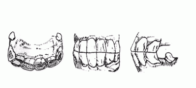 5 нас: Бүх шүд байнгын шүдээр солигджээ
